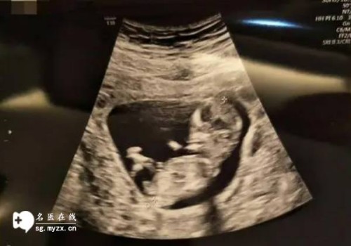 杭州三代试管助孕：卵巢功能异常会出现空卵泡,找对方法最重要